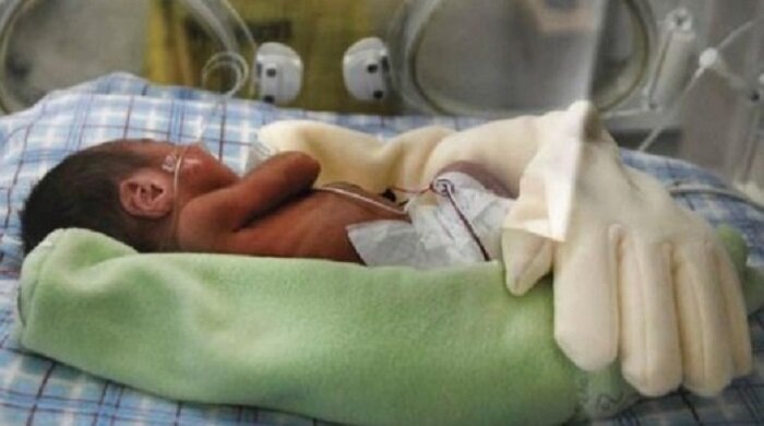 Мама прикрыла недоношенного ребеночка перчаткой. Медсестры были глубоко тронуты…